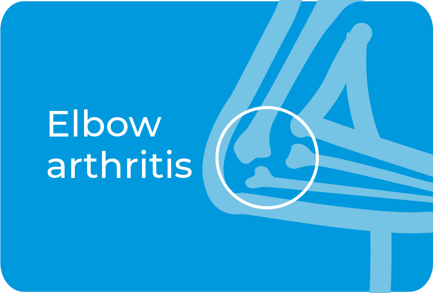 Elbow arthritis