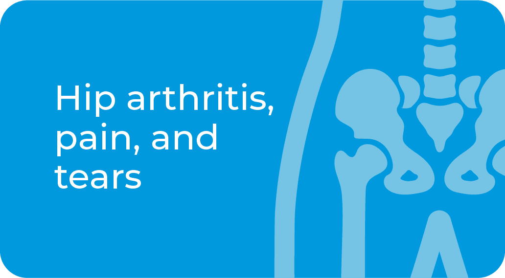 Hip arthritis, pain, and tears