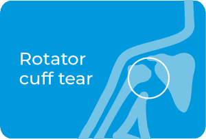 Shoulder and Elbow Care - Campbell Clinic Orthopaedics