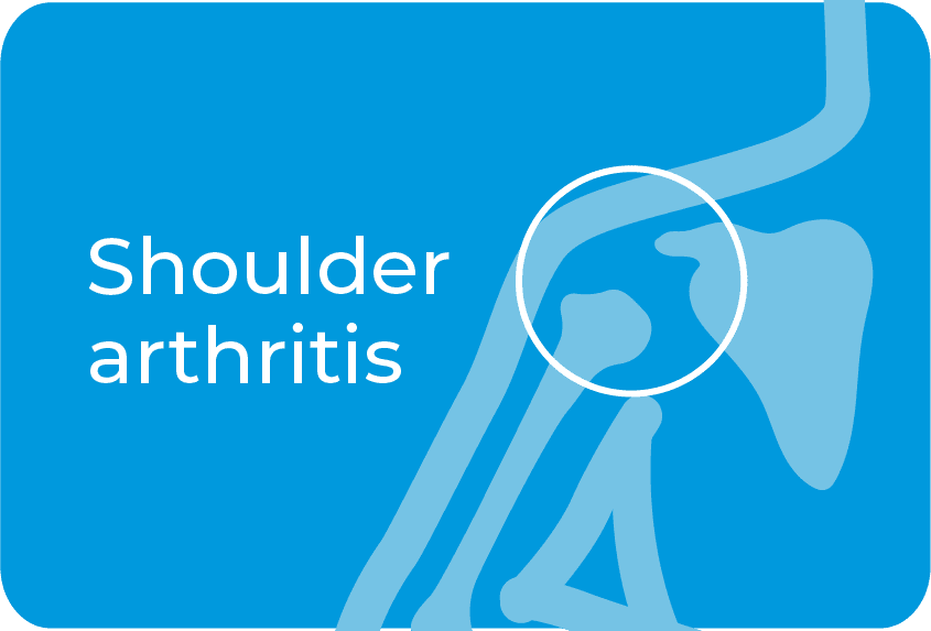 Shoulder arthritis